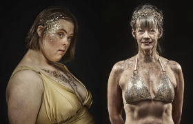 Una campaña de bañadores que celebra la diversidad corporal y la belleza de las cicatrices